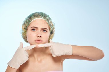 Çıplak omuzlu bir kadın, yüz dermatolojisine sivilceler sıkıyor.