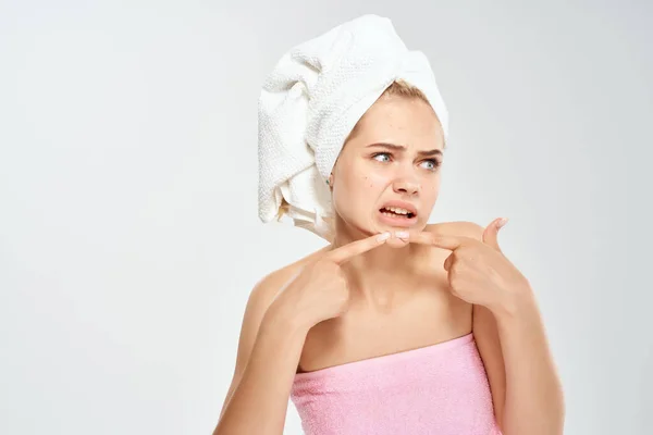 顔の皮膚科のにきびのにきびを絞り出す裸の肩を持つ女性 — ストック写真