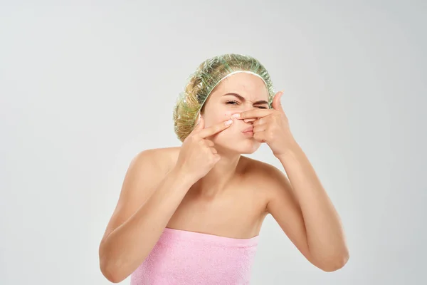 Vrouw knijpt puistjes op haar gezicht dermatologie huidproblemen — Stockfoto