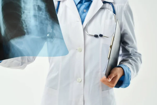 Рентгенолог у білому пальто рентген крупним планом — стокове фото