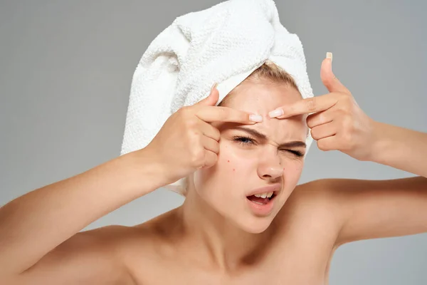 Mujer con hombros desnudos cuidado facial dermatología acné — Foto de Stock