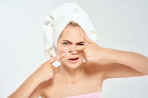 Kvinna med bara axlar ansiktsbehandling akne dermatologi närbild — Stockfoto