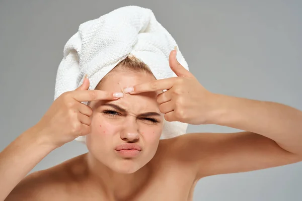Vrouw met handdoek op hoofd naakte schouders gezicht huidverzorging gezondheid — Stockfoto