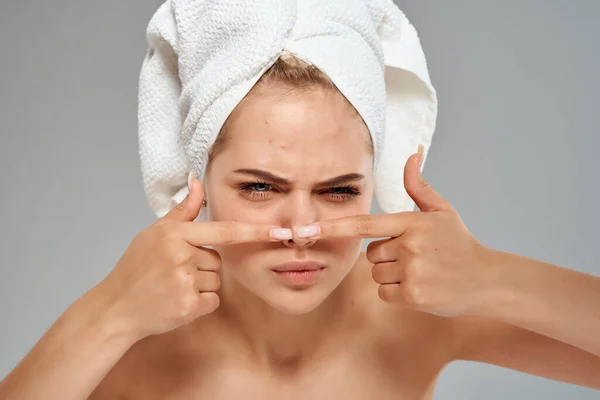 Mulher bonita com toalha na cabeça dermatologia cuidados da pele higiene — Fotografia de Stock