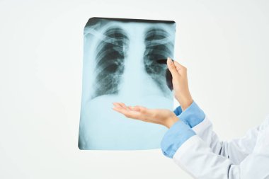 Ciğerlerin röntgeni. Yakın çekim inceleme ışığı arka planı.