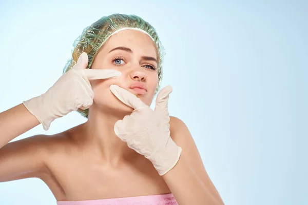 Mulher em luvas de toalha rosa aperta espinhas dermatologia — Fotografia de Stock