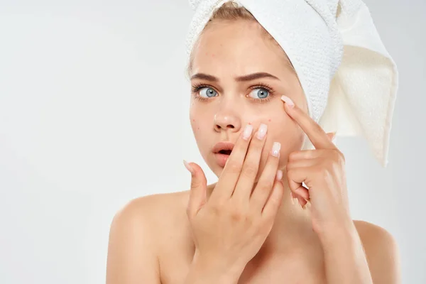 Kvinna med handduk på huvudet hälsa ren hud punkt i ansiktet — Stockfoto