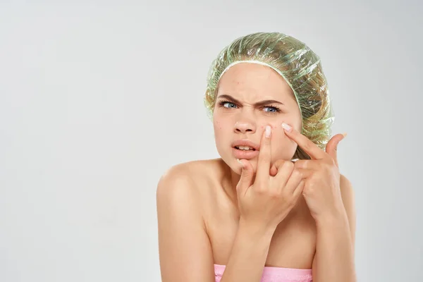 Vrouw met blote schouders huidproblemen — Stockfoto