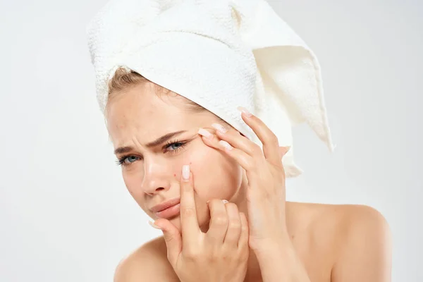 Mujer con una toalla en la cabeza descontento problemas de la piel fondo claro — Foto de Stock
