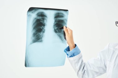 Ciğerlerin röntgeni. Yakın çekim inceleme ışığı arka planı.