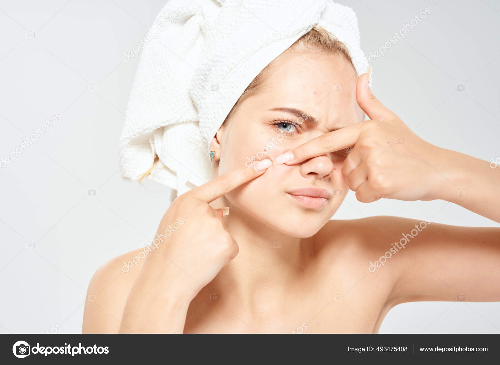 Una Mujer Con Una Toalla En La Cabeza Exprime El Acné En Su Cara