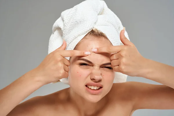Mujer con hombros desnudos apretar espinillas en su toalla facial en su cabeza fondo claro — Foto de Stock