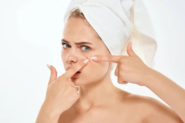 Mujer sosteniendo problemas de la piel de la cara hombros desnudos primer plano — Foto de Stock