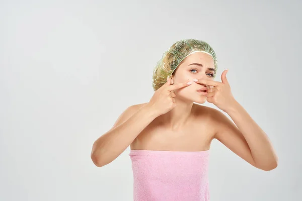 Mulher em uma toalha rosa espremer pontos pretos em seus problemas de pele do rosto — Fotografia de Stock