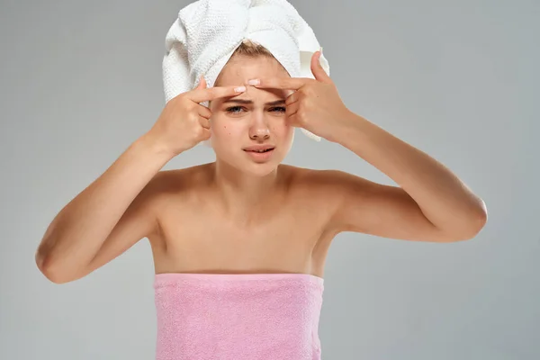 Wanita cantik dengan handuk di kulit kepala dermatologi perawatan kesehatan — Stok Foto