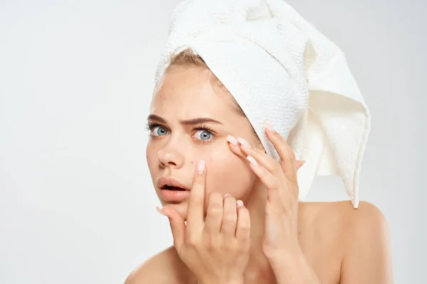 Гарна жінка з рушником на голові шкіра проблеми дерматологія — стокове фото