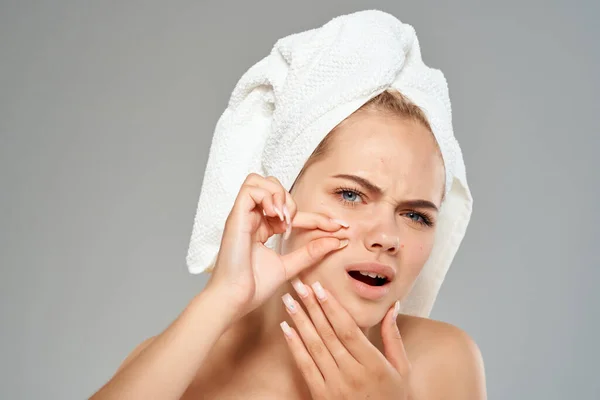 Mujer bonita con una toalla en mi cabeza dermatología problemas de la piel facial — Foto de Stock