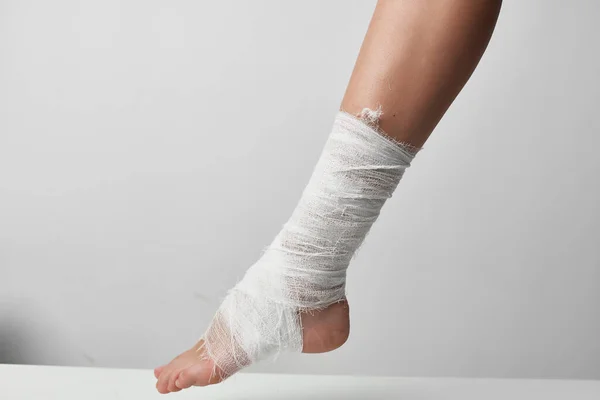 Bandaged leg health problems injury medicine — Stock Photo, Image