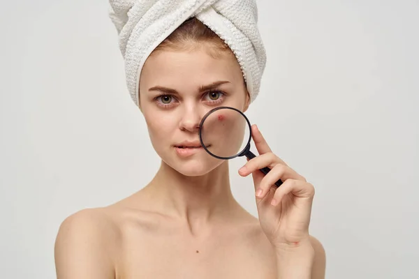 Жінка з прищами на обличчі емоції гігієна косметологія — стокове фото