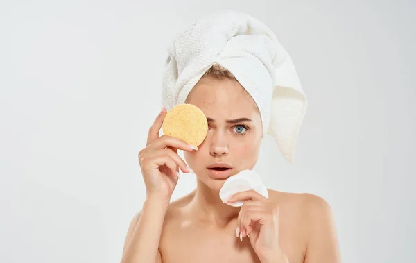 Belle femme avec une serviette sur ma tête problèmes de peau du visage dermatologie — Photo