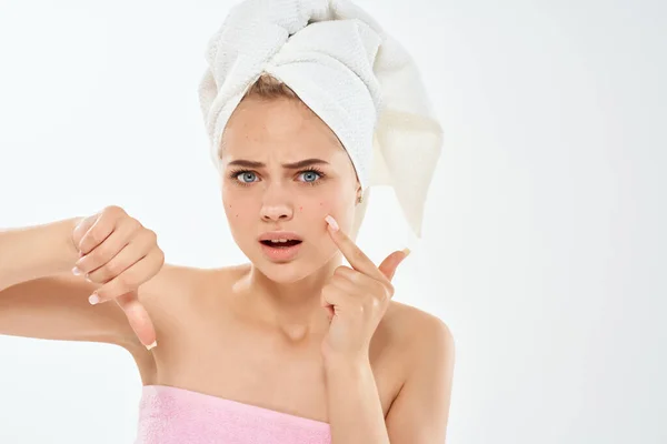Kvinna med bara axlar hudvård dermatologi missnöje hygien — Stockfoto