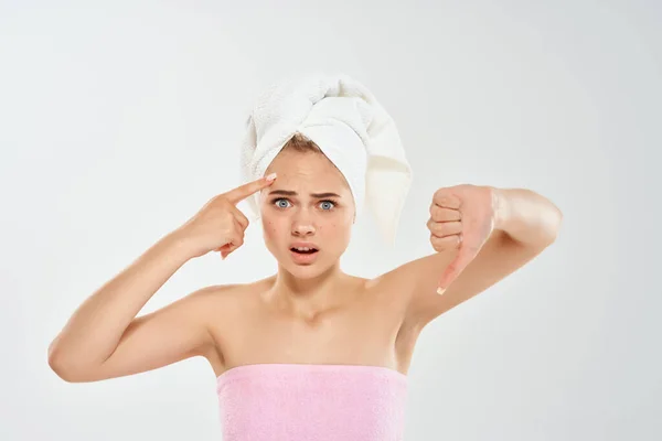 Kvinna med handduk på huvudet håller ansikte hudvård dermatologi hälsa — Stockfoto