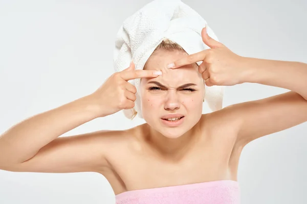 頭にタオルをつけた女性は顔のきれいな肌ににきびを絞る健康 — ストック写真