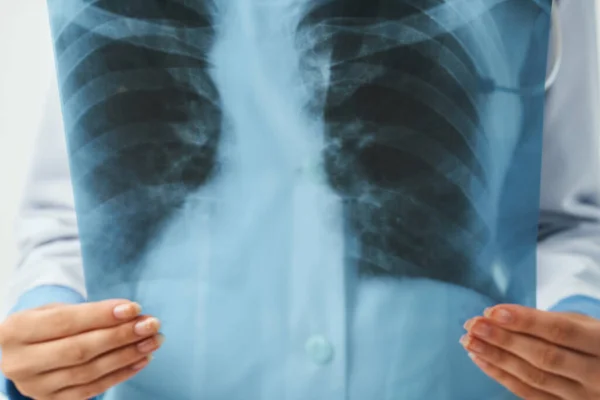 Arts radioloog x-ray onderzoek gezondheid ziekenhuis — Stockfoto