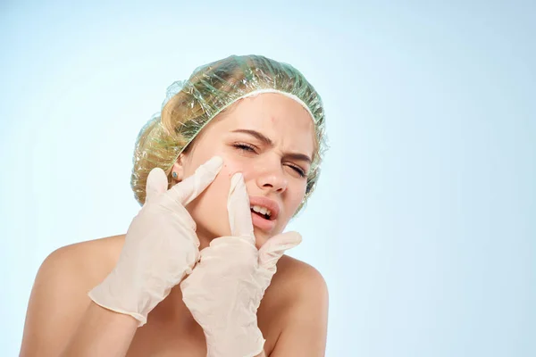 Bonita mujer gorra de ducha acné en la dermatología facial — Foto de Stock