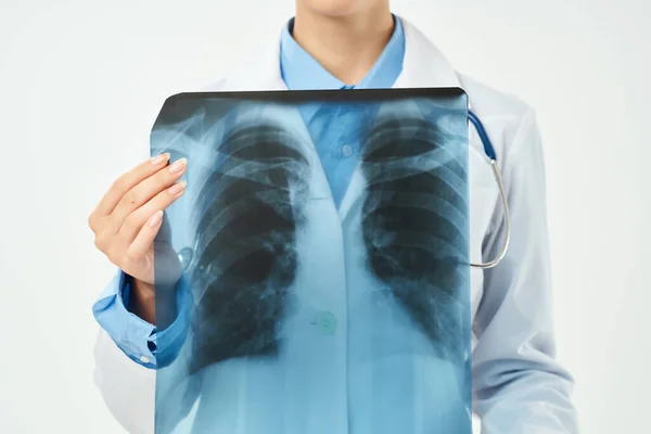 Médico fêmea de raio-x diagnóstico de pesquisa hospital — Fotografia de Stock