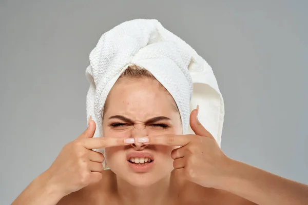 Žena s holými rameny vytlačuje pupínky na obličeji dermatologie akné — Stock fotografie