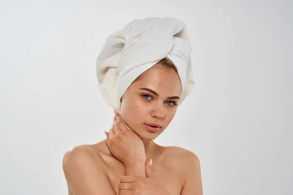 Bonita mujer con una toalla en la cabeza facial problemas de la piel granos — Foto de Stock