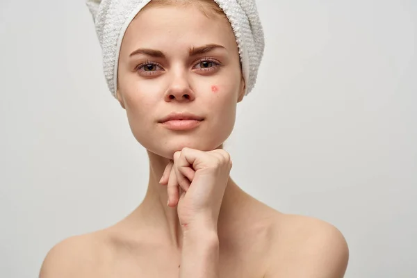Hermosa mujer con una toalla en mi cabeza dermatología aislado fondo — Foto de Stock