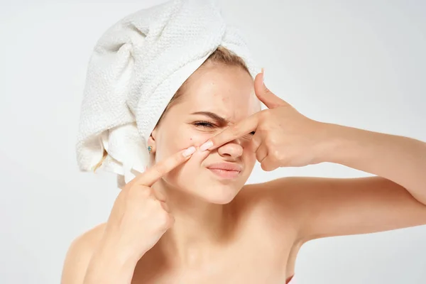 Kvinna med bara axlar pressar ut finnar på dermatologi missnöje ansikte — Stockfoto