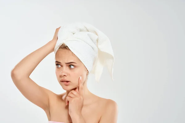 Gyönyörű nő egy törülközővel a fejemen pattanások az arc higiénia — Stock Fotó