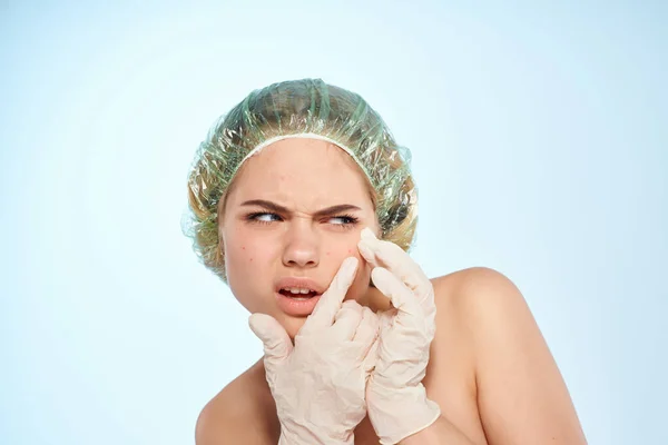 Vrouw met blote schouders in handschoenen knijpt zwarte stippen op haar gezicht — Stockfoto