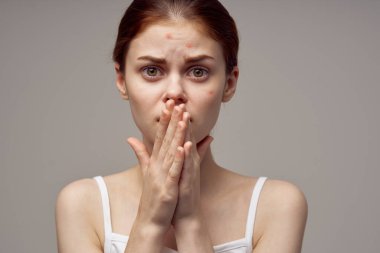 Güzel kadın yüz derisi problemleri yakın plan dermatoloji