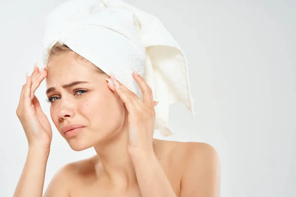 Kafasında havlu olan kadın akne dermatolojisi tatminsiz cilt sorunları — Stok fotoğraf
