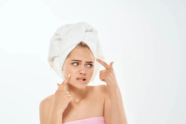 Ongelukkige vrouw met blote schouders huidproblemen dermatologie — Stockfoto