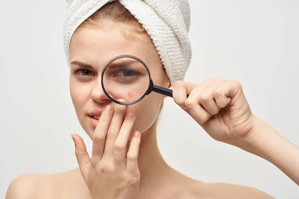 Mulher com uma espinha no rosto dermatologia fundo isolado — Fotografia de Stock