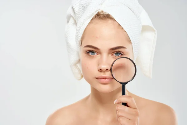 Mujer bonita con una toalla en la cabeza problemas de la piel facial Estudio — Foto de Stock