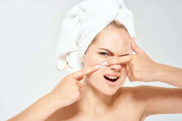 Mulher bonita com uma toalha na minha cabeça acne no fundo da luz do rosto — Fotografia de Stock