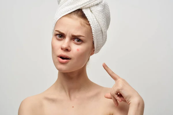 Gyönyörű nő egy pattanás az arcon bőrgyógyászat elszigetelt háttér — Stock Fotó