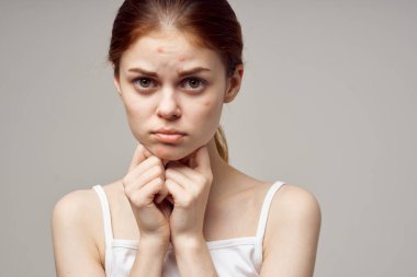 Güzel kadın yüz derisi problemleri dermatoloji açık arkaplan