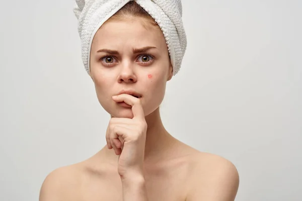 Kvinna bar axlar dermatologi isolerad bakgrund — Stockfoto