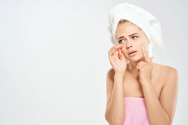 Hübsche Frau mit einem Handtuch auf dem Kopf Hautprobleme Dermatologie — Stockfoto