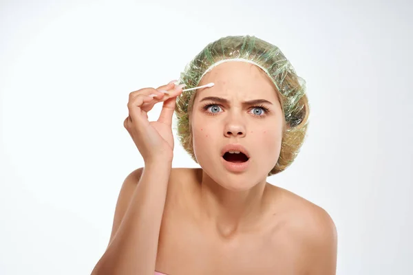 Woman bare shoulders acne treatment dermatology — Stock Photo, Image