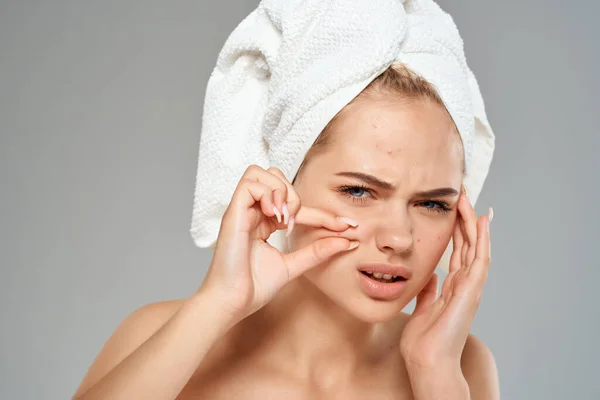 Mujer bonita con toalla en la cabeza exprime granos en la cara —  Fotos de Stock