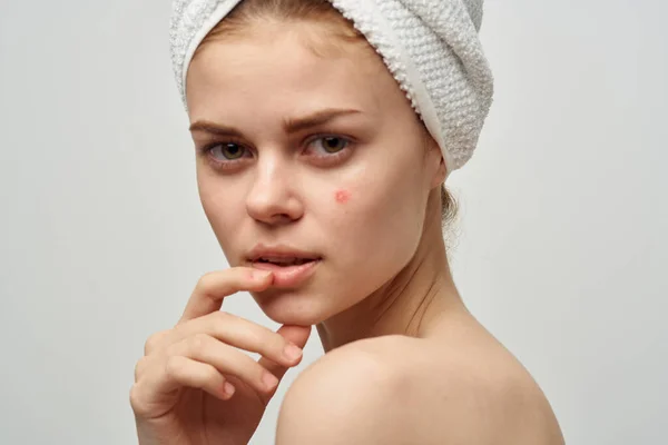 Csinos nő egy pattanás az arc kozmetikai stúdió — Stock Fotó