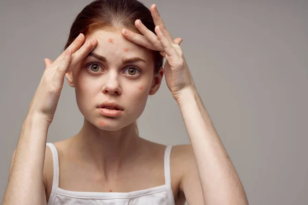 Hermosa mujer cosmetología cuidado de la piel pubertad fondo claro — Foto de Stock